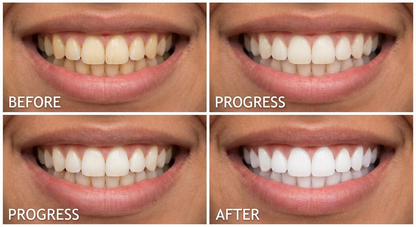 Meansmile Purple Whitening Toothpaste with Instant Stain Removal & Enamel Care