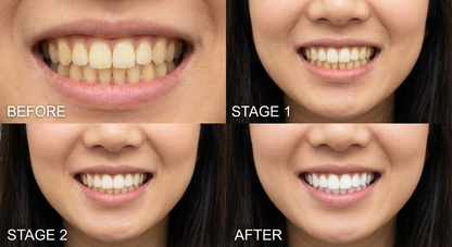 Meansmile Purple Whitening Toothpaste with Instant Stain Removal & Enamel Care