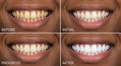 Meansmile Purple Whitening Toothpaste with Instant Stain Removal & Enamel Care