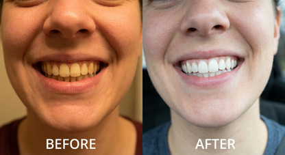 Meansmile Professional Whitening Strips with Coconut Oil & No Mess Formula