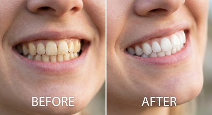 Meansmile Purple Whitening Toothpaste with Instant Stain Removal & Enamel Care